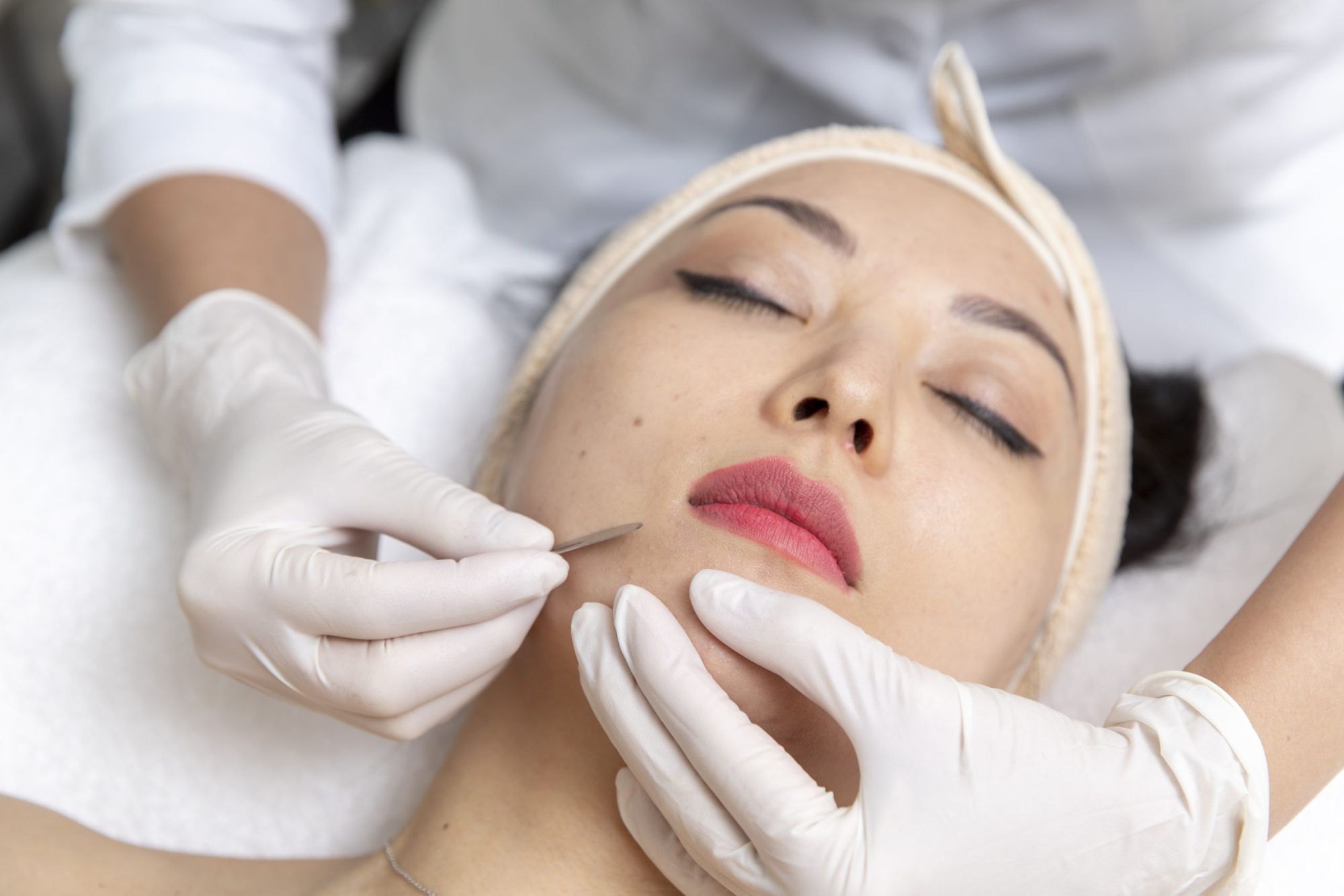 Expert extractions during the Essential Facial